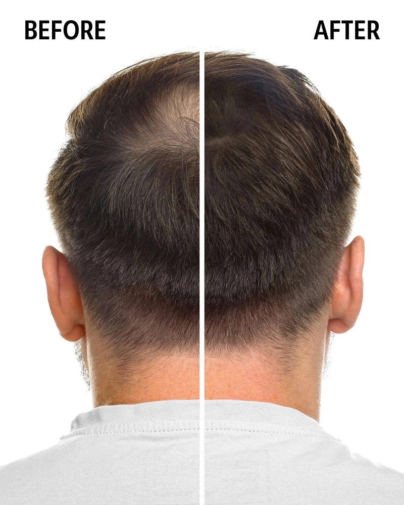 Rescue & Anti-Hair Loss Lotion