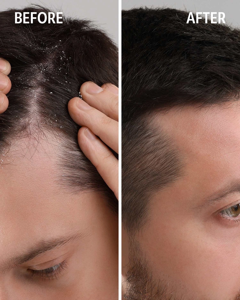 Flakes Free & Soothing Shampoo